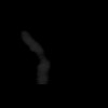 SPORK, NICO - 22.03.1976 - 02.08.2022 - CT obere Extremität - 18:01:46